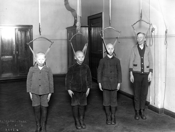 Alte Behandlungsmethode, Drei Jungen stehen nach oben gestreckt durch Kopfbänder gerade und gucken in Richtung Kamera